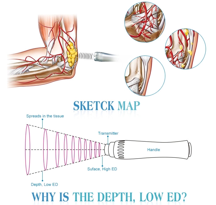 muscle therapy of Shock Wave Therapy Machine – Suyzeko